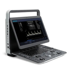 SonoScape E1 Portable Ultrasound Machine