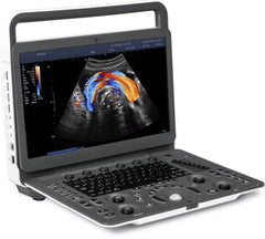 SonoScape E2 Colour Doppler Ultrasound Machine