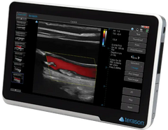 Terason 3200T NexGen