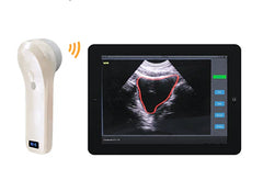 Wireless 4D Bladder Scanner