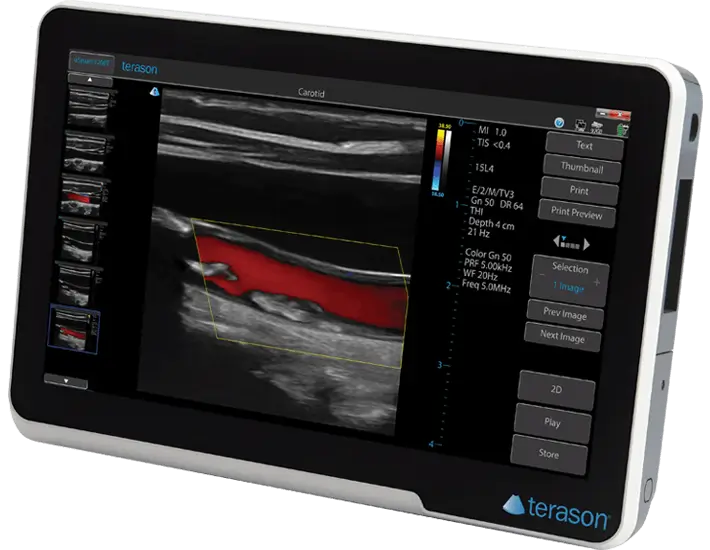 Portable Ultrasound Machine | Handheld POCUS Systems – Eve Zone
