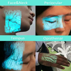 Vein Finder – VeinSight VS400