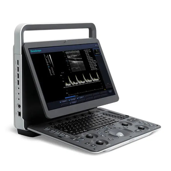 SonoScape E1 Portable Ultrasound Machine