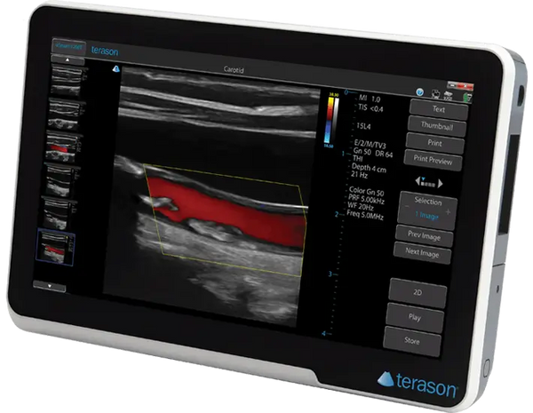 Terason 3200T NexGen