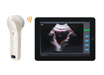 Wireless 4D Bladder Scanner